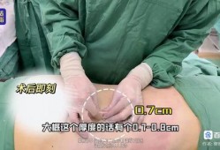 爆料桂哥抽脂视频大全图片,惊心动魄的瘦身之旅